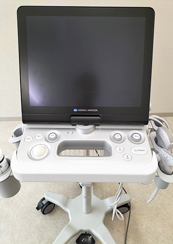 超音波診断装置